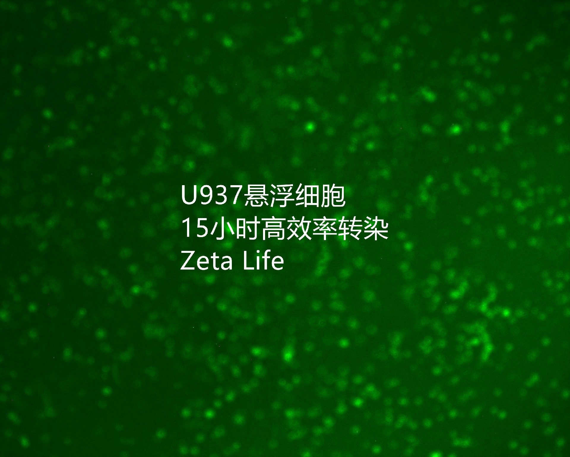 河北医科大学转染micro RNA-u937-荧光.jpg